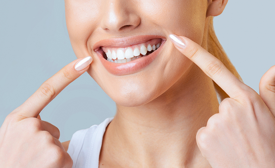 blanquemiento dental