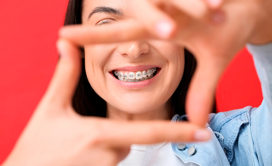brackets-valencia brackets valencia