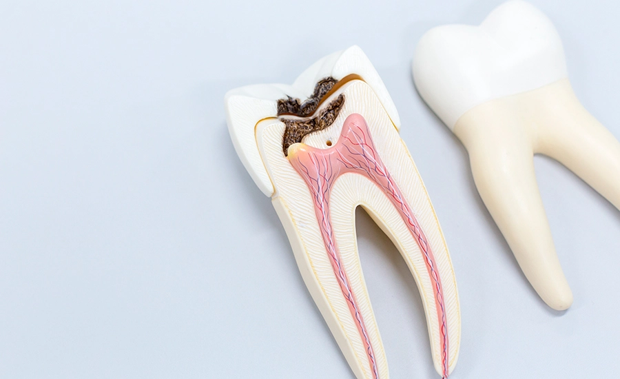 endondoncia endodoncia
